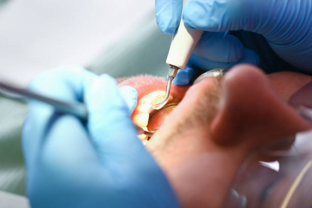 Best Urgent Care for Lost Fillings or Crowns in Smithville, TX