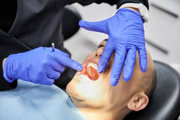 Best Emergency Wisdom Teeth Removal in Smithville, TX