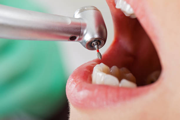 Best Emergency Treatment for Dental Infections or Abscesses in Smithville, TX